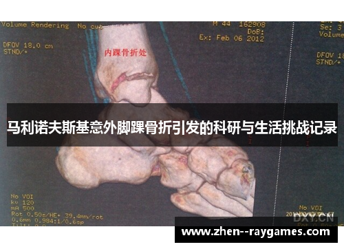 马利诺夫斯基意外脚踝骨折引发的科研与生活挑战记录 马利诺夫斯基意外脚踝骨折引发的科研与生活挑战记录